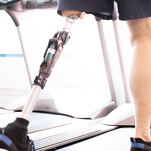 Rehabilitation and the prosthetic leg